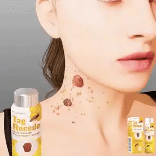 QUITA VERRUGAS TAG RECEDE
