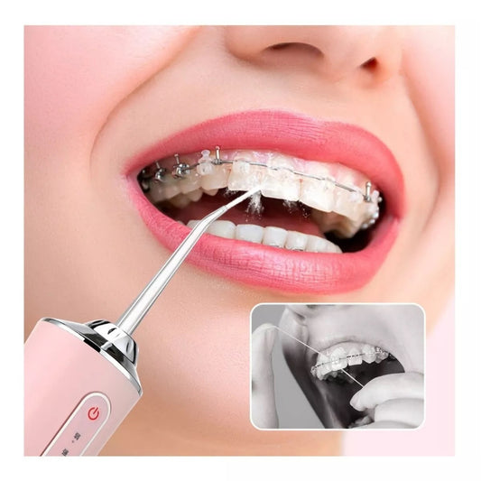 IRRIGADOR BUCAL RECARGABLE