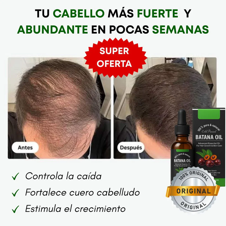 Combo Aceite Batana + Shampo de Batana: El Secreto Ancestral para Prevenir la Caída del Cabello y Estimular el Crecimiento 🌱