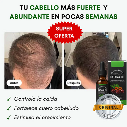 Combo Aceite Batana + Shampo de Batana: El Secreto Ancestral para Prevenir la Caída del Cabello y Estimular el Crecimiento 🌱