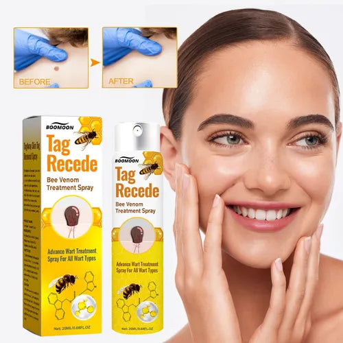 QUITA VERRUGAS TAG RECEDE