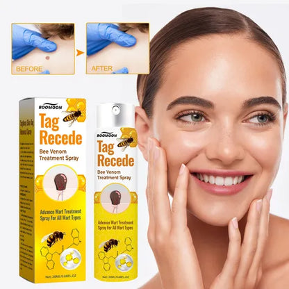 QUITA VERRUGAS TAG RECEDE