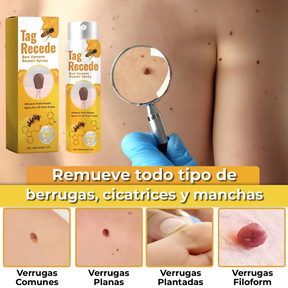 Despídete de las verrugas, lunares y marcas en la piel en 7 días, sin dolor y sin dejar marcas. 🐝